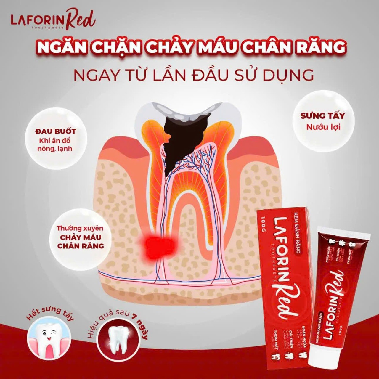 Kem Đánh Răng Laforin Red Toothpaste Dùng Trong Hôi Miệng, Chảy Máu Chân Rặng, Nhiệt Miệng (Lọ 100g)