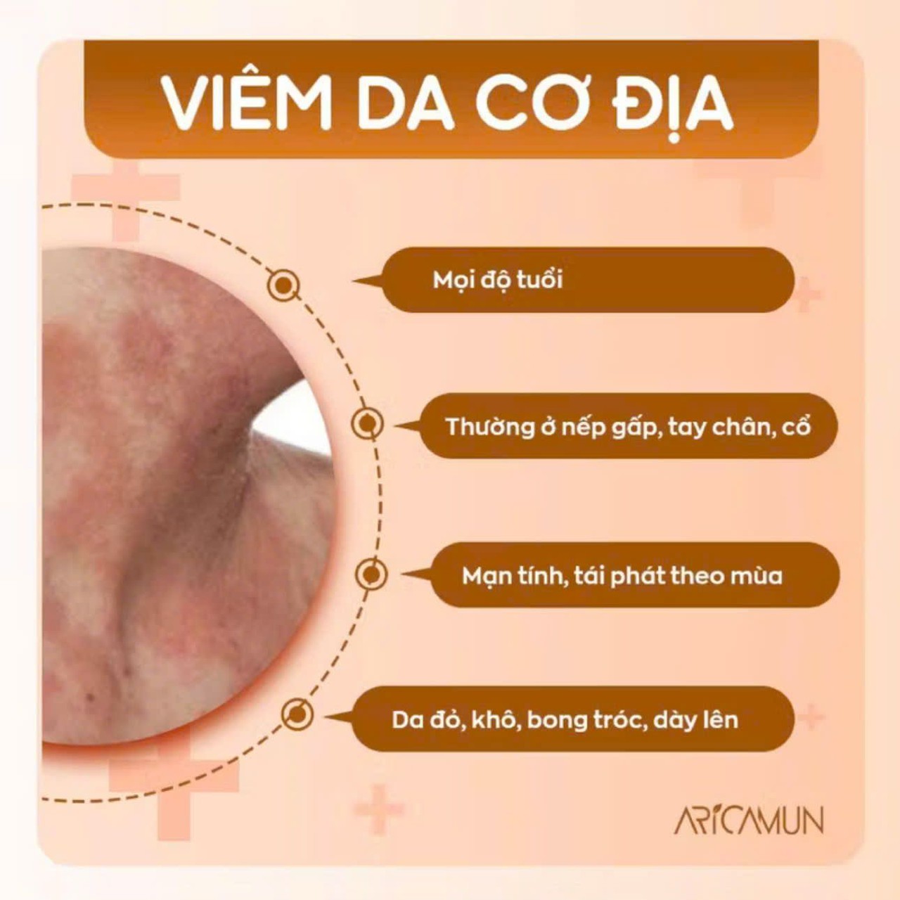 Kem Dưỡng Ẩm Aricamun Moisturizing Cream Giảm Triệu Chứng Chàm Sữa, Viêm Da Cơ Địa Cho Trẻ Sơ Sinh (Tuýp 100g)