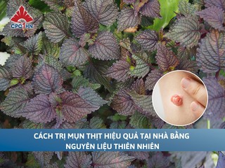 Cách trị mụn thịt hiệu quả tại nhà bằng nguyên liệu thiên nhiên