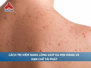 Cách trị viêm nang lông giúp da mịn màng và hạn chế tái phát