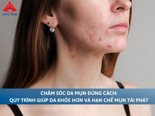 Chăm sóc da mụn đúng cách: Quy trình giúp da khỏe hơn và hạn chế