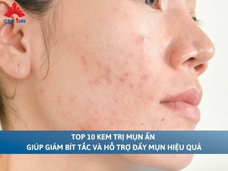 Top 10 kem trị mụn ẩn giúp giảm bít tắc, hỗ trợ đẩy mụn hiệu quả