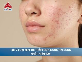 Top 7 loại kem trị thâm mụn được tin dùng nhất hiện nay