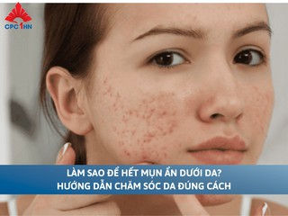 Làm sao để hết mụn ẩn dưới da? Hướng dẫn chăm sóc da đúng cách