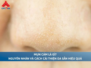 Mụn cám là gì? Nguyên nhân và cách cải thiện da sần hiệu quả