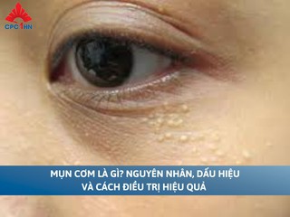 Mụn cơm là gì? Nguyên nhân, dấu hiệu và cách điều trị hiệu quả