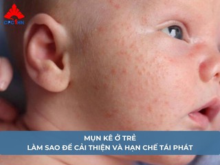 Mụn kê ở trẻ: Làm sao để cải thiện và hạn chế tái phát