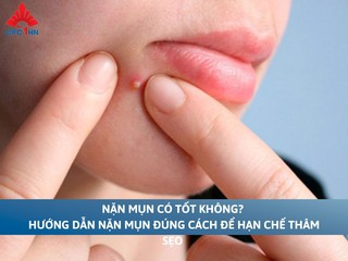 Nặn mụn có tốt không? Hướng dẫn nặn mụn đúng cách để hạn chế thâm