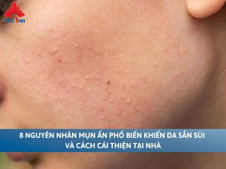 8 nguyên nhân mụn ẩn phổ biến khiến da sần sùi và cách cải thiện