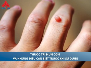 Thuốc trị mụn cơm và những điều cần biết trước khi sử dụng