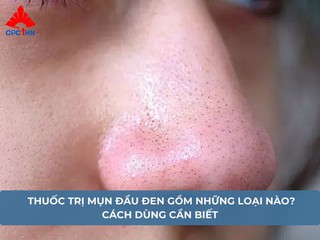 Thuốc trị mụn đầu đen gồm những loại nào? Cách dùng cần biết