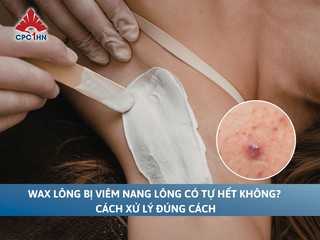 Wax lông bị viêm nang lông có tự hết không? Cách xử lý đúng cách