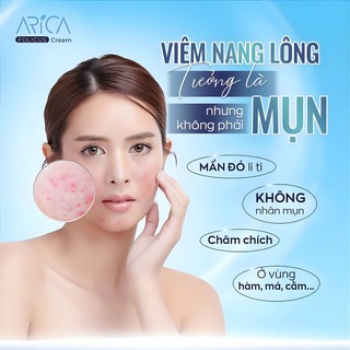 Kem Bôi Viêm Nang Lông Arica Folicus Hỗ Trợ Giảm Mụn Trứng Cá, Dày Sừng, Mơ Thâm Sần (Hộp 1 Tuýp 30g) - thumbnail 6