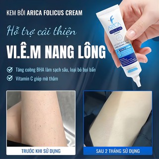 Kem Bôi Viêm Nang Lông Arica Folicus Hỗ Trợ Giảm Mụn Trứng Cá, Dày Sừng, Mơ Thâm Sần (Hộp 1 Tuýp 30g) - thumbnail 2